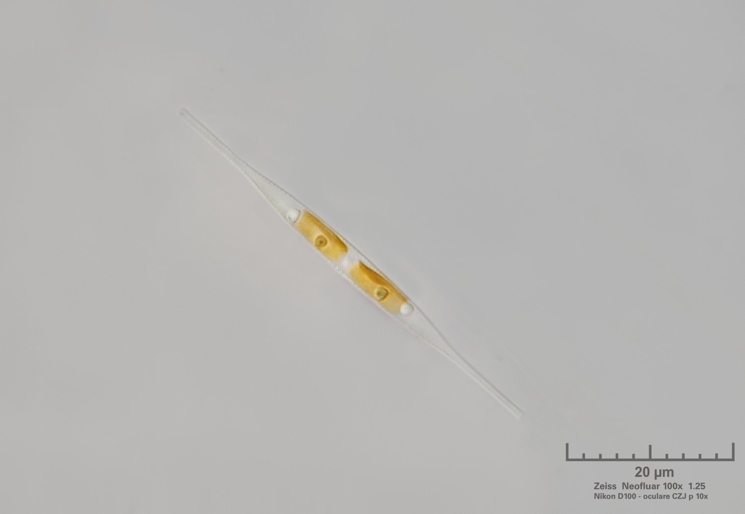Nitzschia
